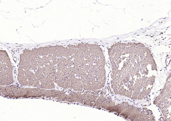 Alpha smooth muscle Actin Mouse Monoclonal Antibody