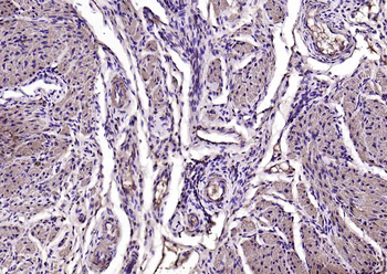 Alpha smooth muscle Actin Mouse Monoclonal Antibody