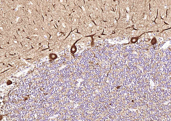 TUBB3 (Neuronal Marker) Mouse Monoclonal Antibody
