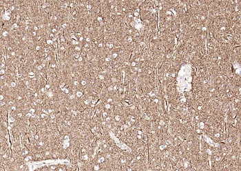 TUBB3 (Neuronal Marker) Mouse Monoclonal Antibody