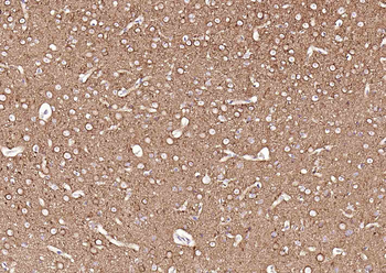 TUBB3 (Neuronal Marker) Mouse Monoclonal Antibody