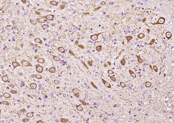 TUBB3 (Neuronal Marker) Mouse Monoclonal Antibody