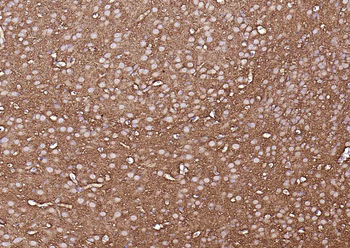 TUBB3 (Neuronal Marker) Mouse Monoclonal Antibody