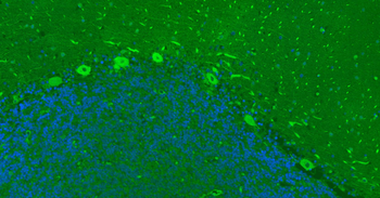 TUBB3 (Neuronal Marker) Mouse Monoclonal Antibody