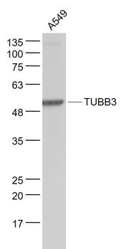TUBB3 (Neuronal Marker) Mouse Monoclonal Antibody