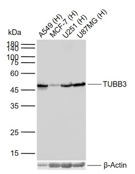 TUBB3 (Neuronal Marker) Mouse Monoclonal Antibody