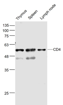 CD4 Rabbit Polyclonal Antibody