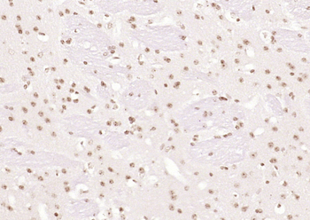 Islet-1 Rabbit Polyclonal Antibody
