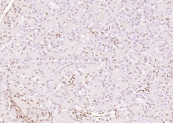 Islet-1 Rabbit Polyclonal Antibody