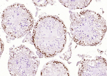 Islet-1 Rabbit Polyclonal Antibody