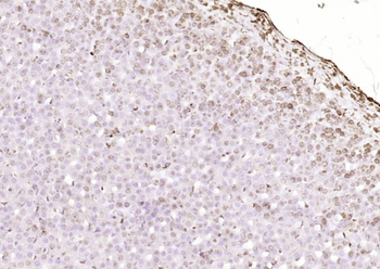 Islet-1 Rabbit Polyclonal Antibody
