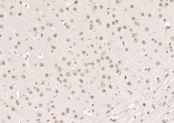 Islet-1 Rabbit Polyclonal Antibody