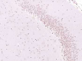 Islet-1 Rabbit Polyclonal Antibody