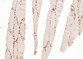 BMP11 Rabbit Polyclonal Antibody