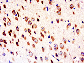 Sphingomyelin Synthase 2 Rabbit Polyclonal Antibody