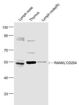 RANKL/CD254 Rabbit Polyclonal Antibody