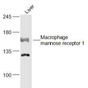 MRC1 Rabbit Polyclonal Antibody