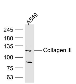 Collagen III Mouse Monoclonal Antibody