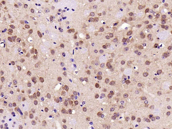 ERK1/2 Mouse Monoclonal Antibody