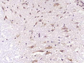 Neutrophil Elastase Rabbit Polyclonal Antibody