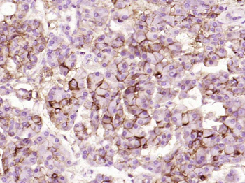 CD44 Mouse Monoclonal Antibody