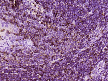 CD44 Mouse Monoclonal Antibody