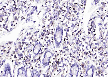 CD45 Mouse Monoclonal Antibody