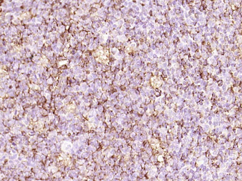 CD45 Mouse Monoclonal Antibody