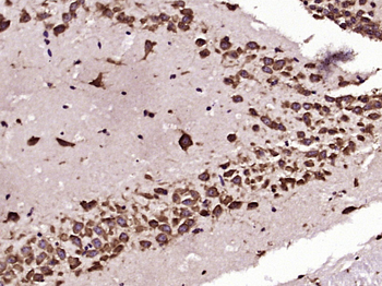 TGF beta 1 Mouse Monoclonal Antibody