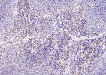 TGF beta 1 Mouse Monoclonal Antibody