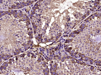 TGF beta 1 Mouse Monoclonal Antibody