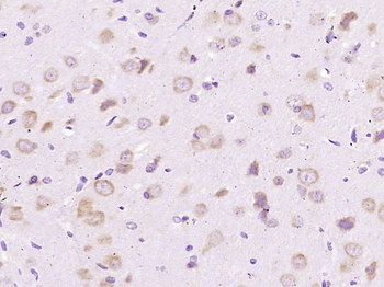 TGF beta 1 Mouse Monoclonal Antibody