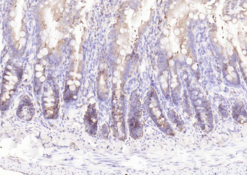TGF beta 1 Mouse Monoclonal Antibody