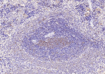 TGF beta 1 Mouse Monoclonal Antibody