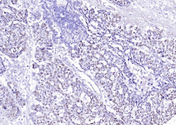 P53 Mouse Monoclonal Antibody