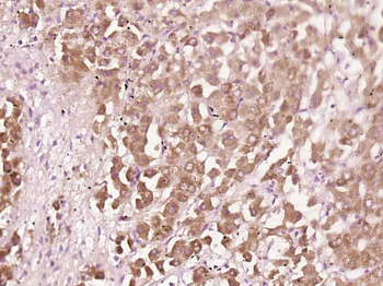 CXCL10/IP10 Rabbit Polyclonal Antibody