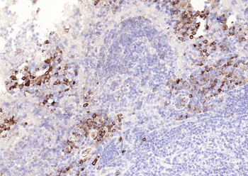 Caspase 8 Mouse Monoclonal Antibody