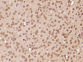ATF6 Rabbit Polyclonal Antibody