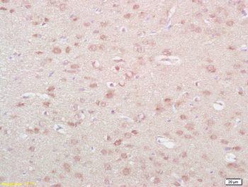 Neurokinin A Rabbit Polyclonal Antibody