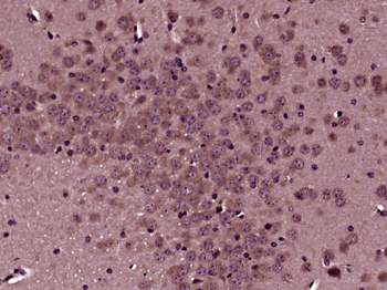 KIT Rabbit Polyclonal Antibody