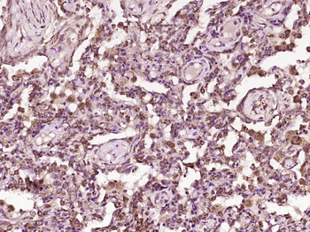 ST2 Rabbit Polyclonal Antibody