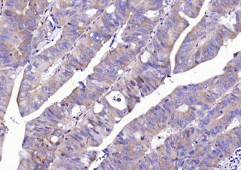NFKB p65 Mouse Monoclonal Antibody