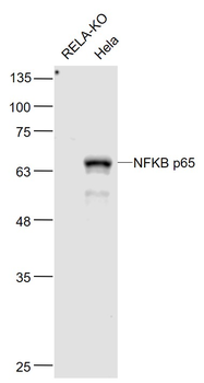 NFKB p65 Mouse Monoclonal Antibody