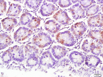 NFKB p65 Mouse Monoclonal Antibody