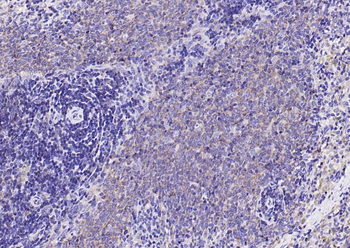 NFKB p65 Mouse Monoclonal Antibody