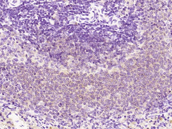 NFKB p65 Mouse Monoclonal Antibody