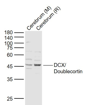 DCX/Doublecortin Rabbit Polyclonal Antibody