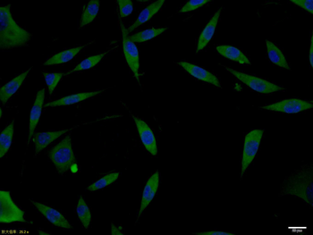 DCX/Doublecortin Rabbit Polyclonal Antibody