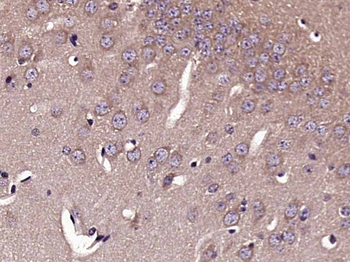 DCX/Doublecortin Rabbit Polyclonal Antibody