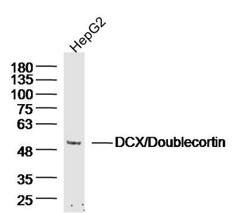DCX/Doublecortin Rabbit Polyclonal Antibody